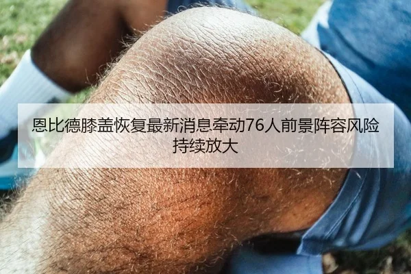 恩比德膝盖恢复最新消息牵动76人前景阵容风险持续放大 - kaiyun